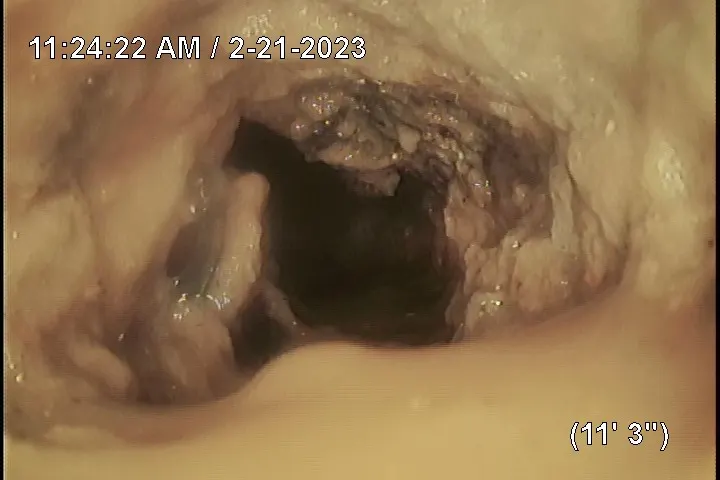Debris and damage inside a sewer pipe seen during inspection